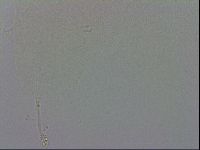 Minibiotus intermedius image