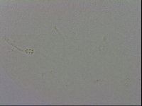 Minibiotus intermedius image
