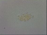 Echiniscus testudo image