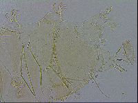 Echiniscus testudo image