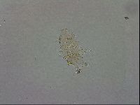 Echiniscus testudo image