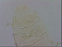 Echiniscus testudo image