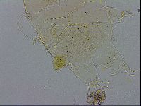 Echiniscus testudo image