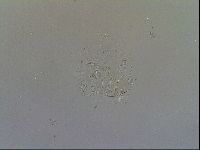 Echiniscus testudo image