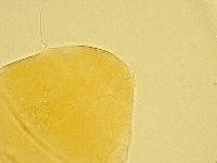 Echiniscus testudo image