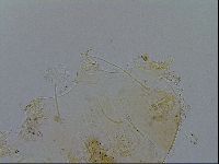 Echiniscus testudo image