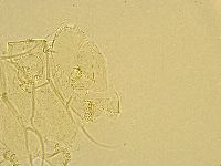 Echiniscus testudo image