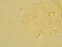 Echiniscus testudo image