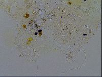 Echiniscus testudo image