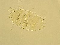 Echiniscus testudo image