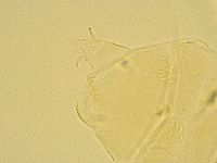 Echiniscus testudo image