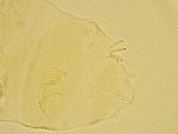Echiniscus testudo image