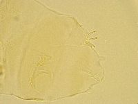 Echiniscus testudo image