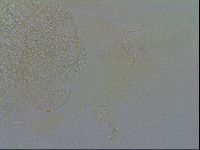Echiniscus testudo image