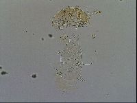 Echiniscus testudo image