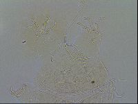 Echiniscus testudo image