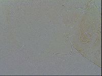 Echiniscus testudo image