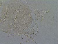 Echiniscus testudo image