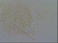 Echiniscus testudo image