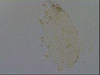 Echiniscus testudo image