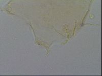Echiniscus testudo image