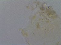 Echiniscus testudo image