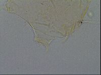 Echiniscus testudo image