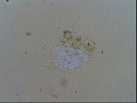 Echiniscus testudo image