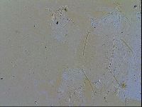 Echiniscus testudo image