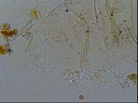 Echiniscus testudo image