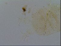 Echiniscus testudo image