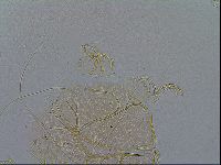 Echiniscus testudo image