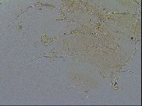 Echiniscus testudo image