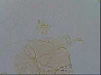 Echiniscus testudo image