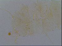 Echiniscus testudo image