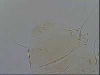 Echiniscus testudo image