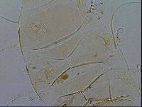Echiniscus testudo image