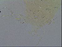Echiniscus testudo image