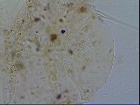 Echiniscus testudo image