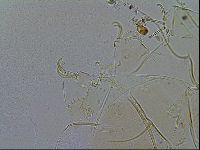 Echiniscus testudo image