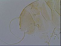 Echiniscus testudo image