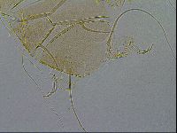 Echiniscus testudo image