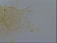 Echiniscus testudo image