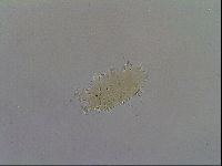 Echiniscus testudo image