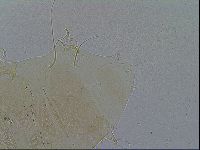 Echiniscus testudo image