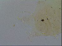 Echiniscus testudo image