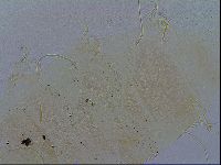 Echiniscus testudo image