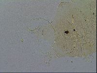 Echiniscus testudo image