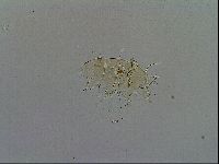 Echiniscus testudo image
