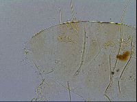 Echiniscus testudo image